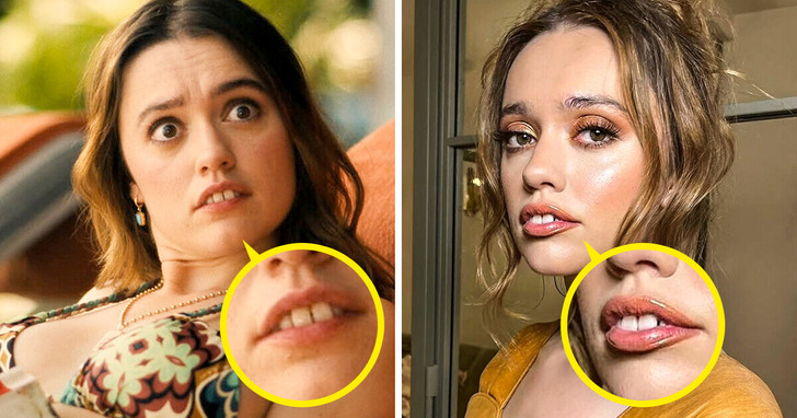 Gwiazda „Białego Lotosa” Aimee Lou Wood przywraca „normalne” zęby — a fani ją uwielbiają