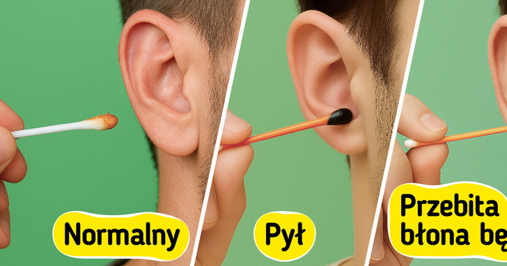 Co mówi kolor twojej woskowiny? 5 sygnałów, których nie wolno lekceważyć