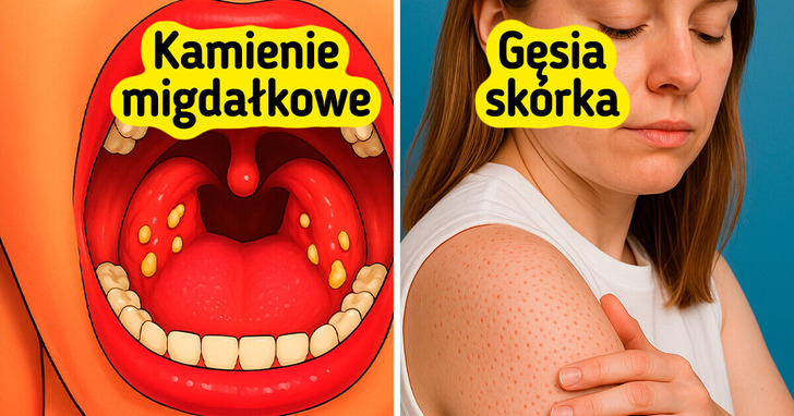 14 oznak, iż twoje ciało może być wrażliwe na gluten