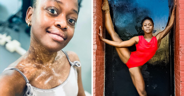 W sierocińcu nazywano ją "dzieckiem diabła" — Jak pewna para adoptowała zaniedbane dziecko i wychowała światowej sławy baletnicę