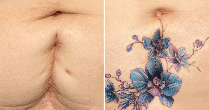 Tatuażystka zamienia blizny swoich klientek w olśniewającą sztukę i dodaje im pewności siebie