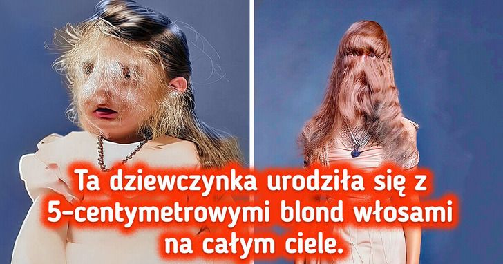 15 zdumiewających fotografii, które dowodzą, iż ludzkie ciało to prawdziwe arcydzieło