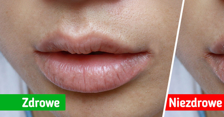 7 sygnałów, które twoje ciało wysyła w razie problemów ze zdrowiem