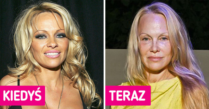 Dlaczego Pamela Anderson sprzedała swój dom wart prawie 12 milionów dolarów, by żyć samotnie z 5 psami