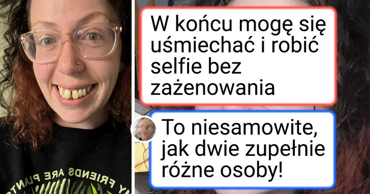 13 porównań zdjęć, które udowadniają, iż ludzie są w stanie zmienić się nie do poznania