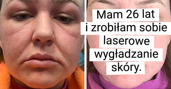 16 osób, które odważyły się na wielkie zmiany i teraz nie można oderwać od nich wzroku