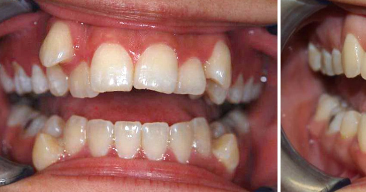 16 osób, które przeszły spektakularne metamorfozy