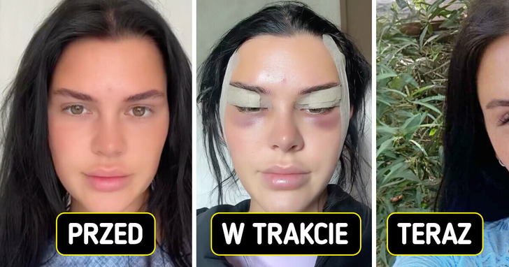 Młoda kobieta podzieliła się relacją z zabiegu „fox eye” — efekt zaskoczył wszystkich