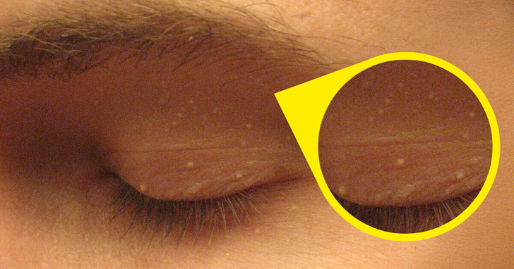 4 subtelne zmiany na twojej twarzy, które mogą wskazywać na problemy zdrowotne