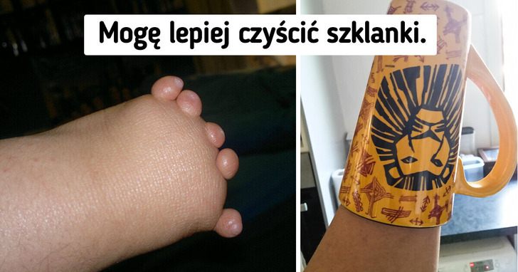 15 osób, które choćby z najtrudniejszej sytuacji potrafią wyciągnąć jakiś pozytyw