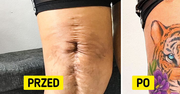 11 osób, które wymyśliły sposób, żeby z blizn zrobić dzieło sztuki