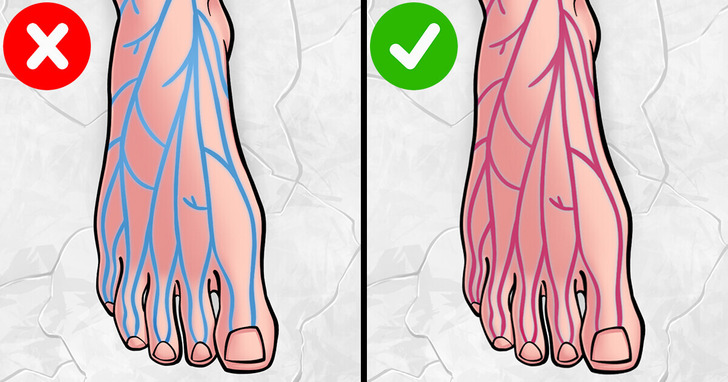 9 symptomów niedoboru żelaza, których możesz nie zauważać