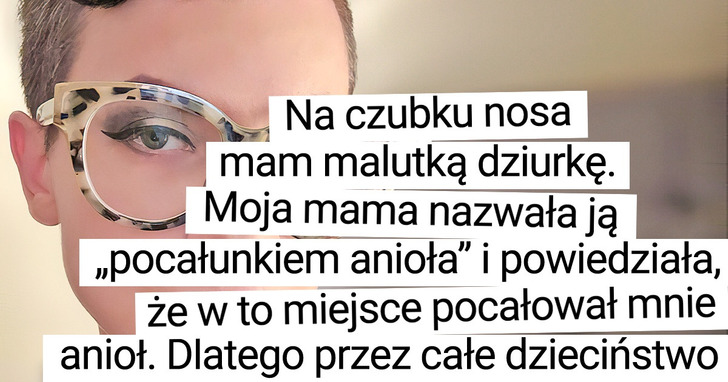 21 dziewczyn, które zaakceptowały swoje nieszablonowe nosy, co dało im prawdziwe szczęście