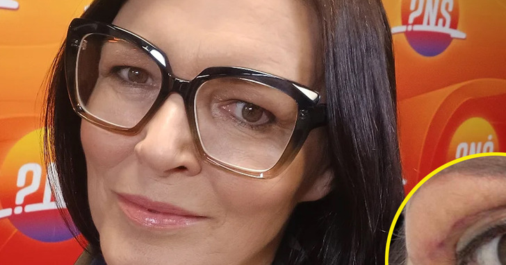 Jak jedna operacja sprawiła, iż słynna Ilona Felicjańska zapomniała o swoich zasadach