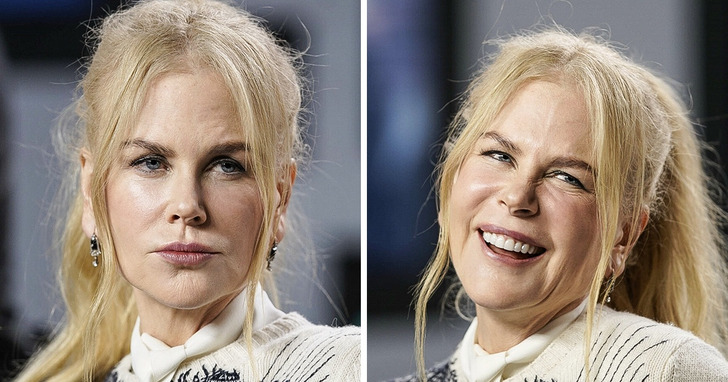 19 zdjęć gwiazd na dowód, iż uśmiech potrafi nas zmienić nie do poznania