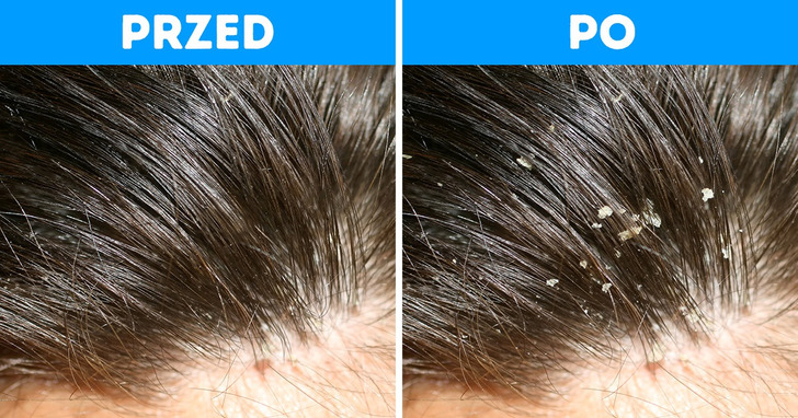 5 oznak sygnalizujących, iż zbyt często myjesz włosy