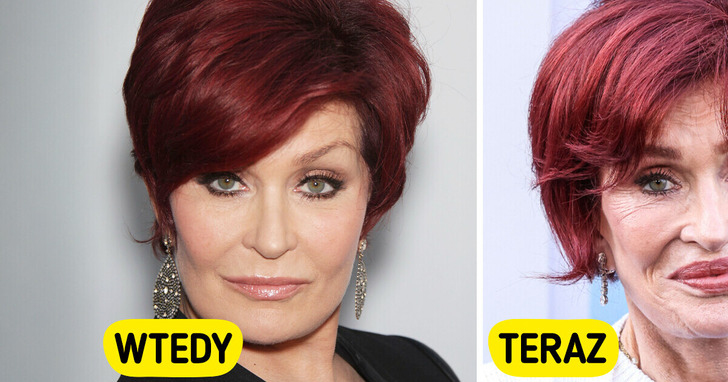 „Chyba przesadziłam” — 72-letnia Sharon Osbourne opowiada o swojej przemianie