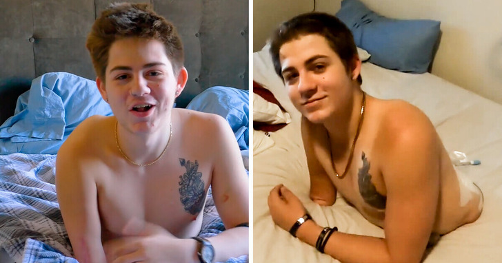 Mężczyzna przecięty na pół przez wózek widłowy stawia czoła przeciwnościom losu, by żyć i inspirować miliony