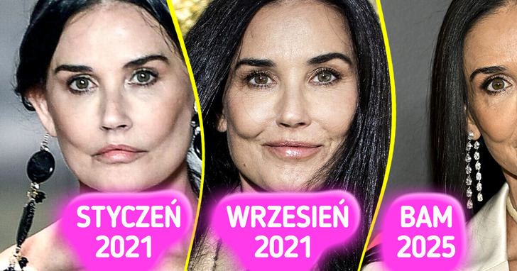 Twarz Demi Moore pod lupą — eksperci ujawniają, co ją zmieniło