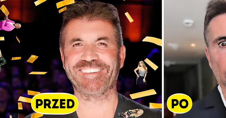 „Co się stało z jego twarzą?!” — nowy wygląd Simona Cowella zaniepokoił fanów
