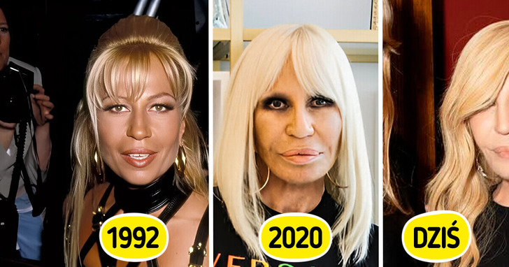 „Wiecznie młoda” — drastyczna przemiana 70-letniej Donatelli Versace wprawia fanów w osłupienie