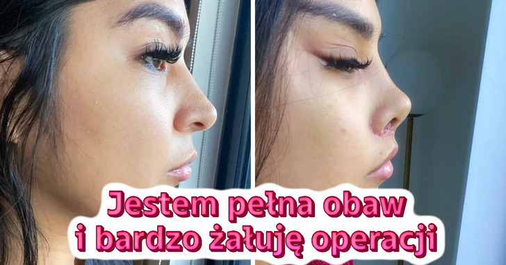 16 osób, które postanowiły zmienić swój wygląd, ale nie są pewne, czy efekt im się podoba