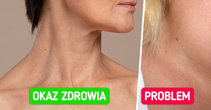 6 objawów, które mogą świadczyć o problemach z tarczycą