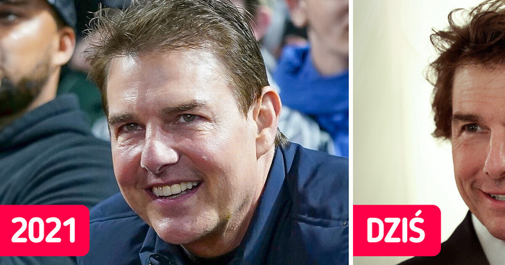 Tom Cruise jest nie do poznania na najnowszych zdjęciach z księciem Williamem. Niektórzy twierdzą, iż przeszedł „zbyt wiele operacji”