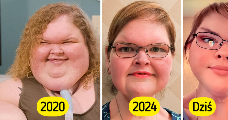 Gwiazda „Sióstr wielkiej wagi” debiutuje po operacji usunięcia nadmiaru skóry. Fani są w szoku