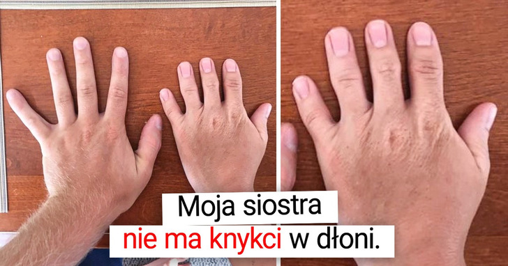 17 osób i zwierząt, które są tak wyjątkowe, iż aż korci, by przebadać ich geny