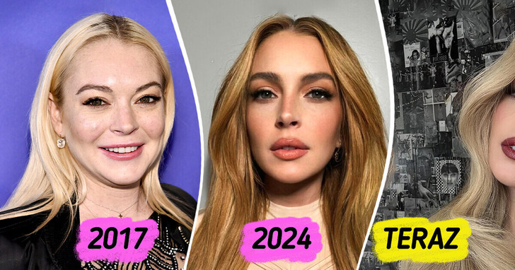 Lindsay Lohan zaskakuje metamorfozą, a ekspert od medycyny estetycznej komentuje jej wygląd