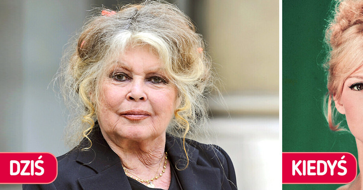 15 celebrytów, którzy wyglądają dziś jak zupełnie inne osoby