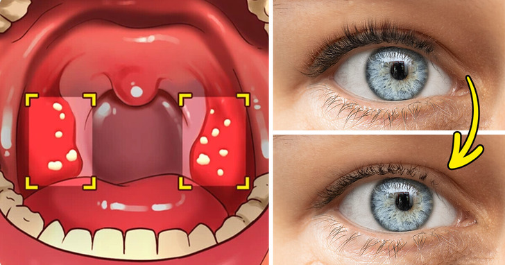 12 objawów mogących sygnalizować nadwrażliwość na gluten