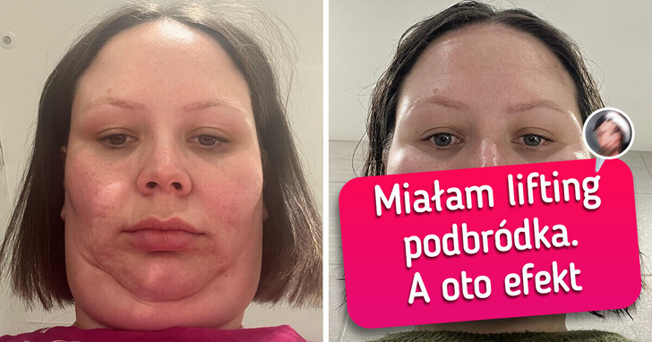 18 osób pochwaliło się swoimi zdjęciami „przed” i „po”