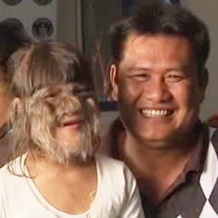 Close up of a girl smiling with a man, her face covered in fur-like hair, homely background.