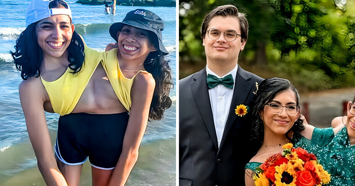 Jedna z bliźniaczek syjamskich wychodzi za mąż — wszyscy mówią to samo