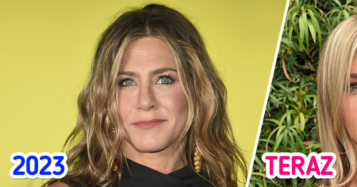 Co się stało z twarzą Jennifer Aniston? Wyjaśnienia od specjalisty