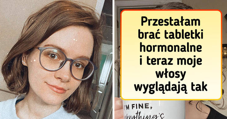 18 osób, które zrezygnowały z zabiegów fryzjerskich i stwierdziły, iż to była świetna decyzja
