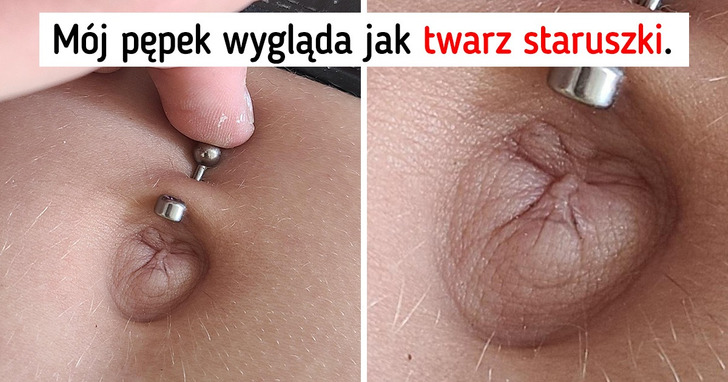 15 przypadków, kiedy geny obdarzyły ludzi i zwierzęta odrobiną magii