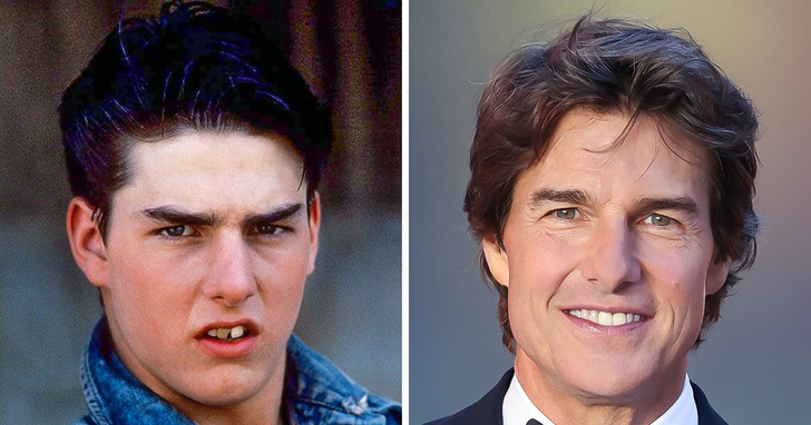 7 celebrytów, którzy przeszli drobną metamorfozę i odmienili swój wygląd