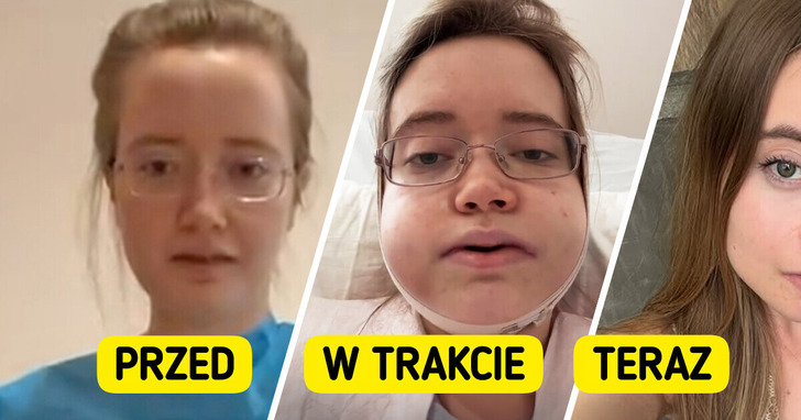 24-latka zdecydowała się na ryzykowny zabieg. Efekt przerósł jej najśmielsze oczekiwania