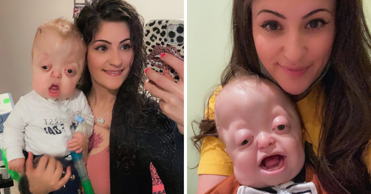 Mama udostępnia zdjęcia swojego synka w sieci, a ludzie błagają ją, by przestała