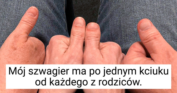 13 osób, które są uosobieniem cudów genetyki