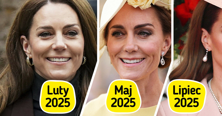 Twarz księżnej Kate się zmienia? W sieci narasta fala spekulacji