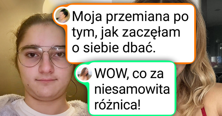15 osób, które zmieniły się nie do poznania, gdy dorosły