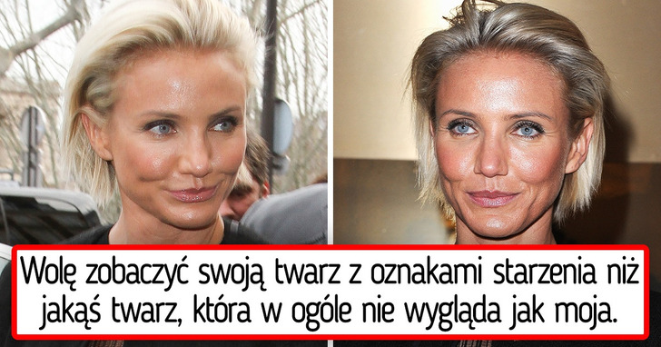 8 znanych kobiet, które poddały się operacji plastycznej po raz pierwszy i ostatni