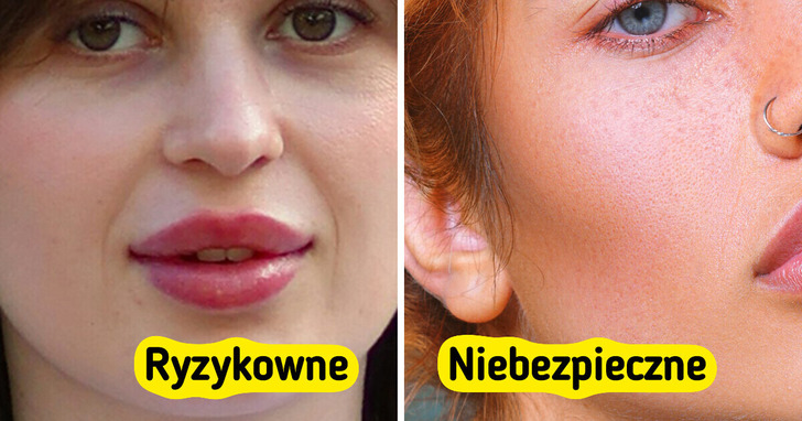 10 popularnych zabiegów kosmetycznych, których lepiej unikać