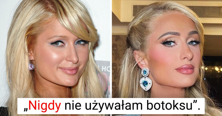 Paris Hilton ujawnia, jak naturalnie zachowuje młody wygląd w wieku 41 lat