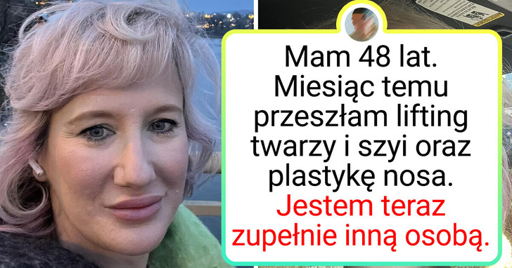 20 zdjęć, które pokazują niezwykłą zmianę na lepsze