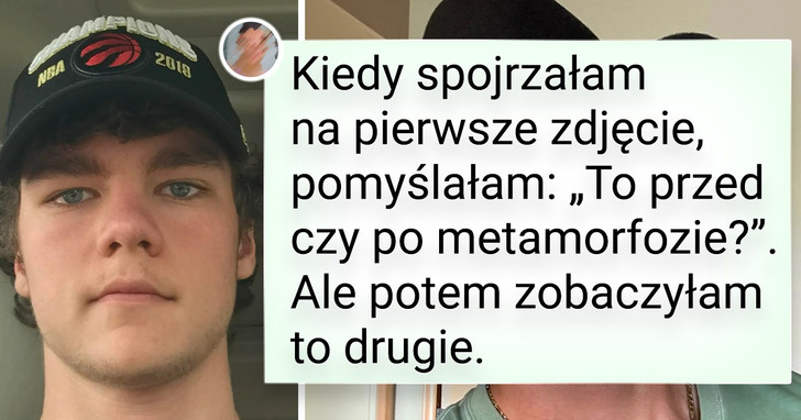 18 osób, które postanowiły zaprezentować światu swoje nastoletnie metamorfozy